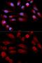 Tumor Protein P53 Binding Protein 1 antibody, GTX64370, GeneTex, Immunocytochemistry image 