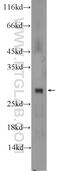 Tetratricopeptide Repeat Domain 32 antibody, 25422-1-AP, Proteintech Group, Western Blot image 