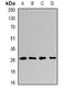 Proteasome Inhibitor Subunit 1 antibody, orb340936, Biorbyt, Western Blot image 