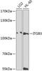 Integrin Subunit Beta 3 antibody, 18-698, ProSci, Western Blot image 