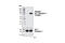 Insulin Like Growth Factor 1 Receptor antibody, 4568S, Cell Signaling Technology, Western Blot image 