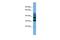 Crystallin Zeta Like 1 antibody, PA5-42798, Invitrogen Antibodies, Western Blot image 