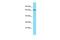 Zinc Finger AN1-Type Containing 4 antibody, PA5-46306, Invitrogen Antibodies, Western Blot image 