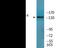 Insulin Receptor Substrate 1 antibody, EKC2437, Boster Biological Technology, Western Blot image 