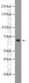 Secreted Phosphoprotein 1 antibody, 22952-1-AP, Proteintech Group, Western Blot image 