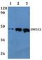 Zinc Finger Protein 232 antibody, A15088-1, Boster Biological Technology, Western Blot image 