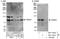 Tudor Domain Containing 3 antibody, NBP1-46821, Novus Biologicals, Western Blot image 