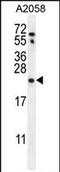 RAB10, Member RAS Oncogene Family antibody, PA5-71649, Invitrogen Antibodies, Western Blot image 