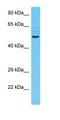 UBX Domain Protein 7 antibody, orb327138, Biorbyt, Western Blot image 