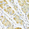 Complement Component 4 Binding Protein Beta antibody, LS-C334661, Lifespan Biosciences, Immunohistochemistry paraffin image 