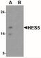 Hes Family BHLH Transcription Factor 5 antibody, NBP2-41305, Novus Biologicals, Western Blot image 