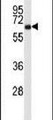 Cortactin antibody, PA5-26254, Invitrogen Antibodies, Western Blot image 