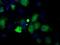 Profilin 1 antibody, GTX83903, GeneTex, Immunofluorescence image 