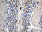 SN antibody, M04779, Boster Biological Technology, Immunohistochemistry paraffin image 