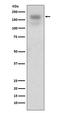 MER Proto-Oncogene, Tyrosine Kinase antibody, M00489, Boster Biological Technology, Western Blot image 