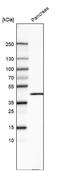 Carboxypeptidase A1 antibody, NBP2-76509, Novus Biologicals, Western Blot image 