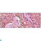 Glycogen Synthase Kinase 3 Alpha antibody, LS-C813975, Lifespan Biosciences, Immunohistochemistry paraffin image 