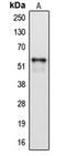 Cytochrome P450 2A6 antibody, LS-C352083, Lifespan Biosciences, Western Blot image 