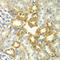 Receptor Interacting Serine/Threonine Kinase 2 antibody, LS-C332122, Lifespan Biosciences, Immunohistochemistry paraffin image 