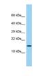 Lymphocyte Antigen 6 Family Member G6D antibody, orb326618, Biorbyt, Western Blot image 