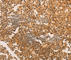 Telomerase Reverse Transcriptase antibody, A2979, ABclonal Technology, Immunohistochemistry paraffin image 