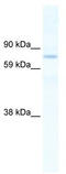 SIN3 Transcription Regulator Family Member B antibody, TA341813, Origene, Western Blot image 
