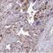 Tensin 3 antibody, NBP2-37948, Novus Biologicals, Immunohistochemistry paraffin image 