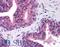 Chromatin Assembly Factor 1 Subunit A antibody, LS-B242, Lifespan Biosciences, Immunohistochemistry paraffin image 