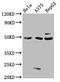 Serine/Threonine Kinase 24 antibody, LS-B13790, Lifespan Biosciences, Western Blot image 