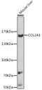 Collagen Type II Alpha 1 Chain antibody, 16-129, ProSci, Western Blot image 
