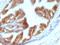 Epithelial Cell Adhesion Molecule antibody, GTX34691, GeneTex, Immunohistochemistry paraffin image 