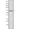 Dual Specificity Tyrosine Phosphorylation Regulated Kinase 2 antibody, abx149951, Abbexa, Western Blot image 