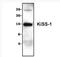 KiSS-1 Metastasis Suppressor antibody, NBP1-45672, Novus Biologicals, Western Blot image 