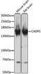 Calcium Dependent Secretion Activator antibody, A13186, ABclonal Technology, Western Blot image 