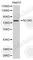 Arachidonate 5-Lipoxygenase antibody, A2158, ABclonal Technology, Western Blot image 