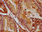 Quiescin Sulfhydryl Oxidase 1 antibody, LS-C681152, Lifespan Biosciences, Immunohistochemistry paraffin image 