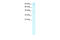 Chromosome 20 Open Reading Frame 194 antibody, 27-415, ProSci, Western Blot image 