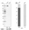 Neogenin 1 antibody, PA5-55695, Invitrogen Antibodies, Western Blot image 