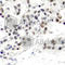 Estrogen Receptor 1 antibody, AP0347, ABclonal Technology, Immunohistochemistry paraffin image 