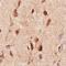 Neurofibromin 1 antibody, NB300-153, Novus Biologicals, Immunohistochemistry frozen image 