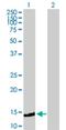 Translocase Of Inner Mitochondrial Membrane 10B antibody, H00026515-B01P, Novus Biologicals, Western Blot image 