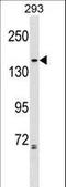 Non-SMC Condensin II Complex Subunit G2 antibody, LS-C164767, Lifespan Biosciences, Western Blot image 