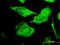 Protein C Receptor antibody, LS-C133652, Lifespan Biosciences, Immunofluorescence image 