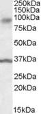 Ankyrin repeat and protein kinase domain-containing protein 1 antibody, LS-B10288, Lifespan Biosciences, Western Blot image 