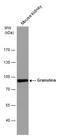 Granulin Precursor antibody, GTX100803, GeneTex, Western Blot image 