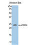 Major Histocompatibility Complex, Class II, DR Alpha antibody, LS-C295279, Lifespan Biosciences, Western Blot image 