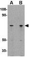 Leucine Rich Repeat LGI Family Member 2 antibody, GTX85409, GeneTex, Western Blot image 