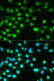 Protein Phosphatase 3 Catalytic Subunit Alpha antibody, STJ25091, St John