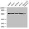 Insulin Like Growth Factor Binding Protein 1 antibody, LS-C369823, Lifespan Biosciences, Western Blot image 