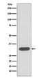 Cyclin Dependent Kinase 4 antibody, M00159-1, Boster Biological Technology, Western Blot image 